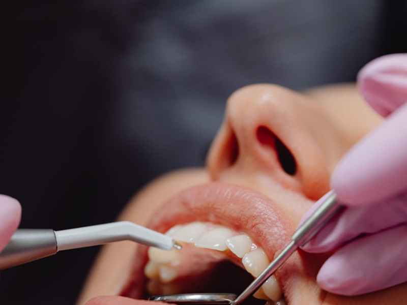 糖尿病患者的戒菸與口腔保健